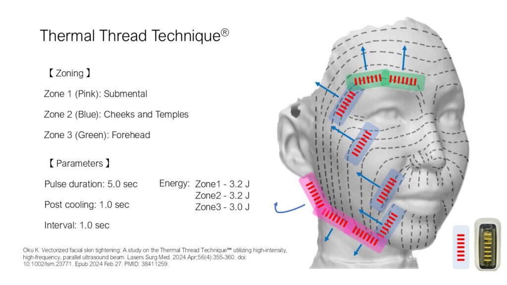 Thermal Thread Technique™で肌質改善！次世代超音波機器ソフウェーブの驚きの効果 | ヒルズグレイスクリニック
