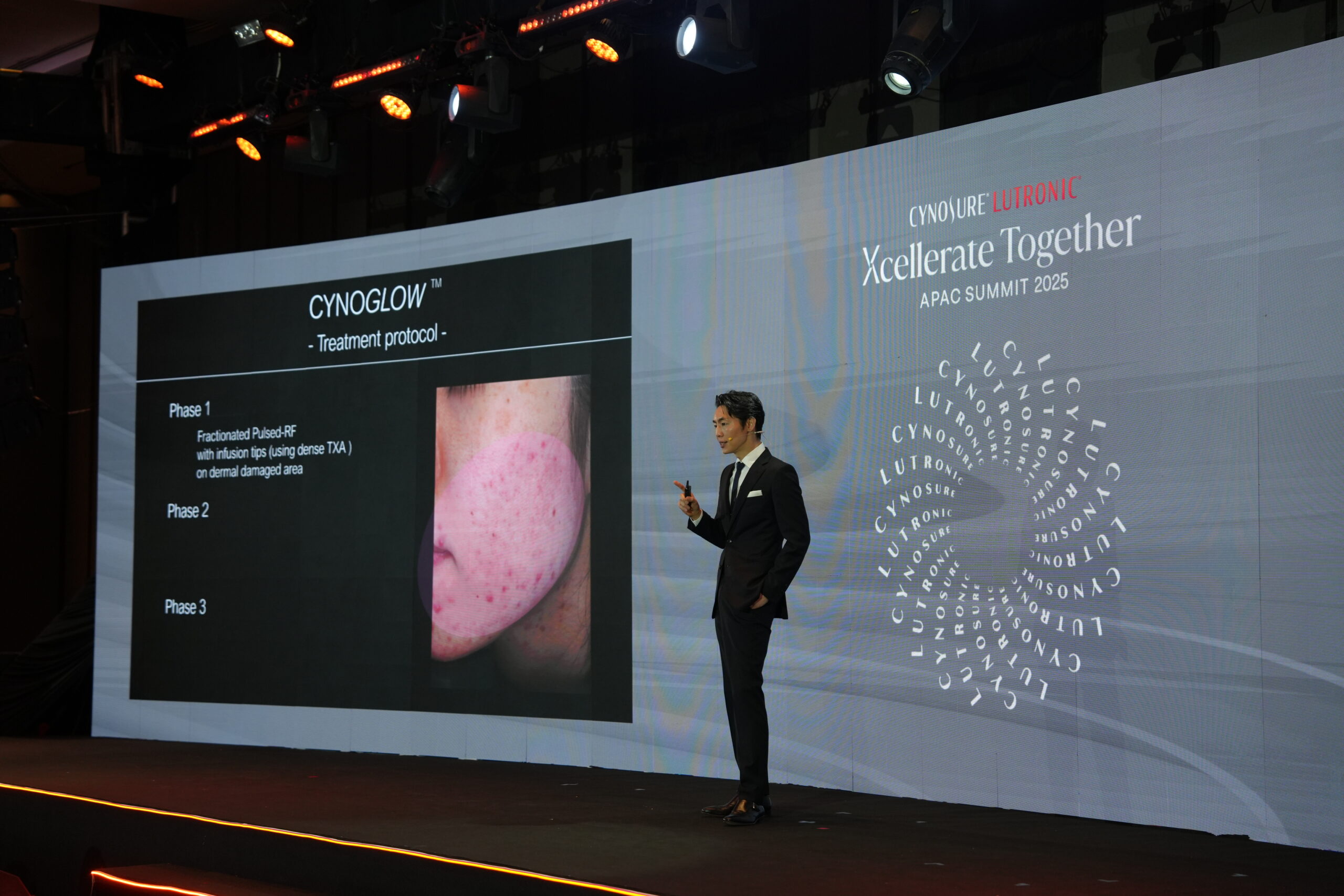 Cynosure Lutronic APAC Summit 2025での講演の様子