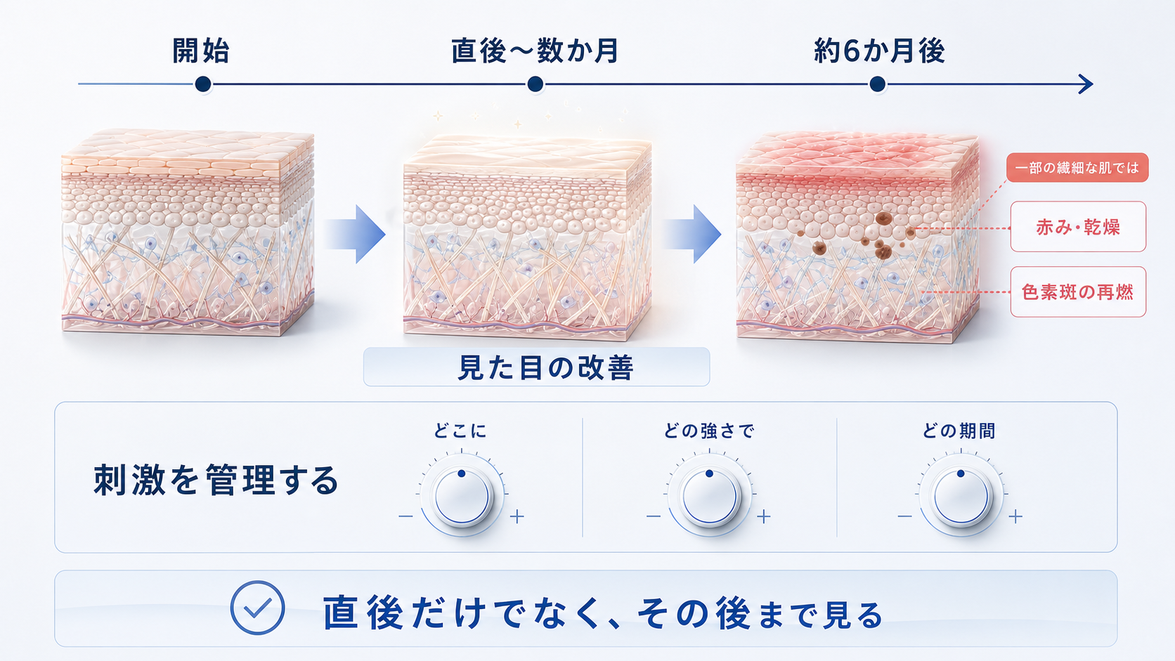 治療直後から約6か月後までの肌変化と刺激管理を示すインフォグラフィック