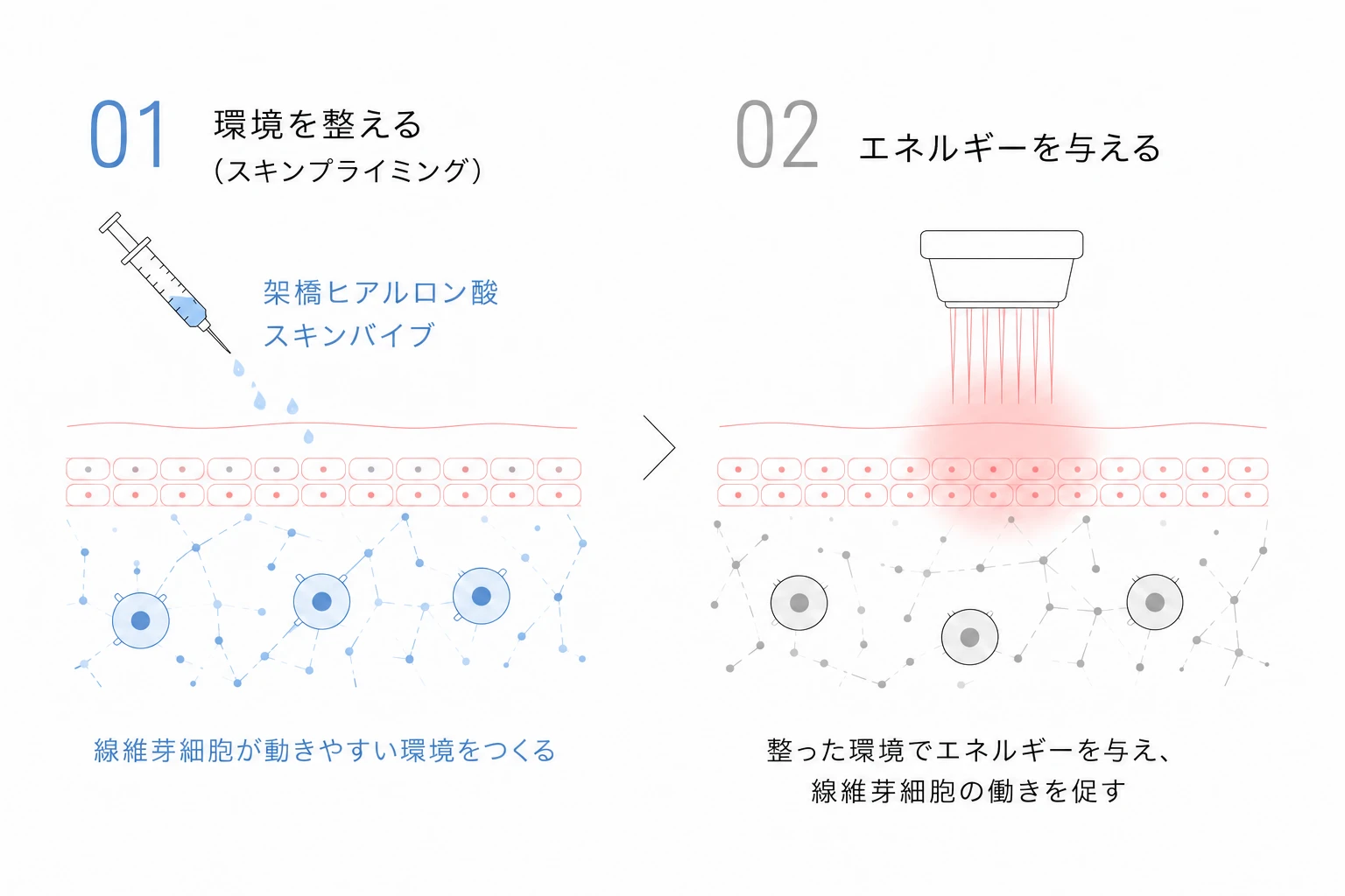 CrossTALK protocol:架橋型ヒアルロン酸で環境を整えてからエネルギーを与える二段階の治療を示す図解