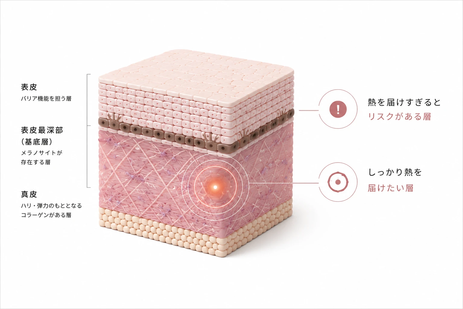 表皮最深部(基底層)のメラノサイトは熱を届けすぎるとリスクがある層、真皮はしっかり熱を届けたい層であることを示す図解