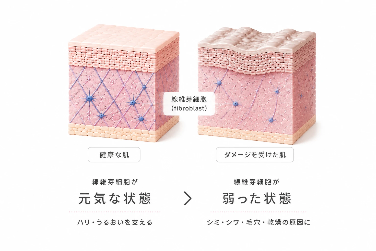 線維芽細胞が元気な健康な肌と弱ったダメージ肌を比較した皮膚断面図