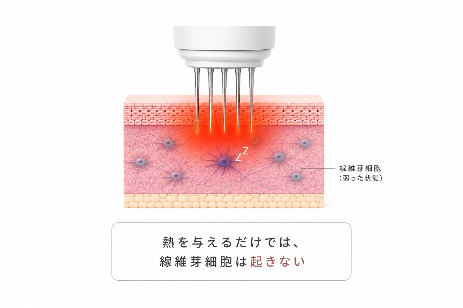 熱を与えるだけでは弱った線維芽細胞は起きないことを示す図解