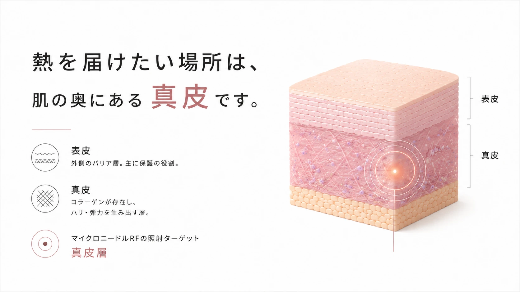 マイクロニードルRFの照射ターゲットは肌の奥にある真皮層であることを示す皮膚断面図