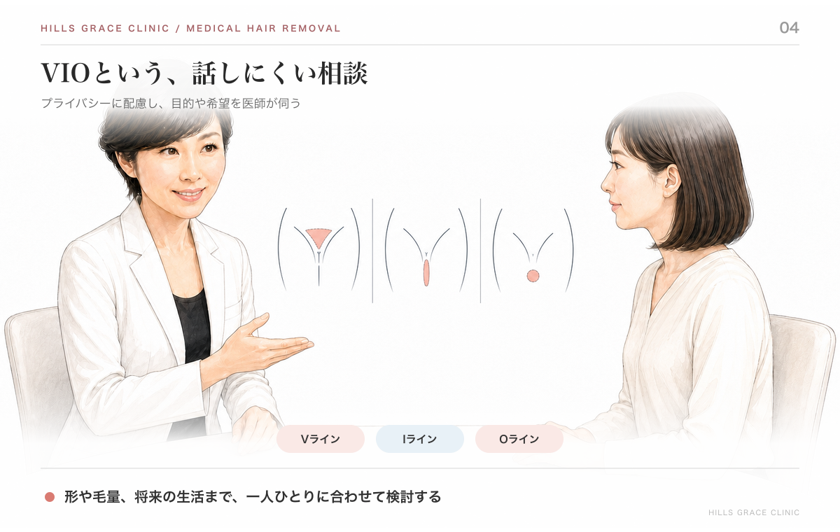 Vライン・Iライン・Oラインの位置をそれぞれ示したデリケートライン脱毛の模式図