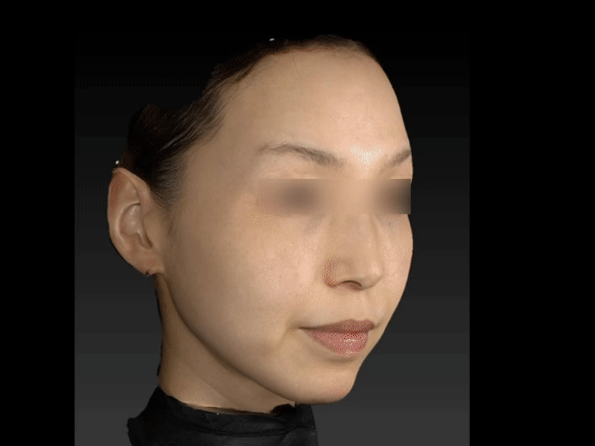 3D解析で確認した顔の立体イメージ