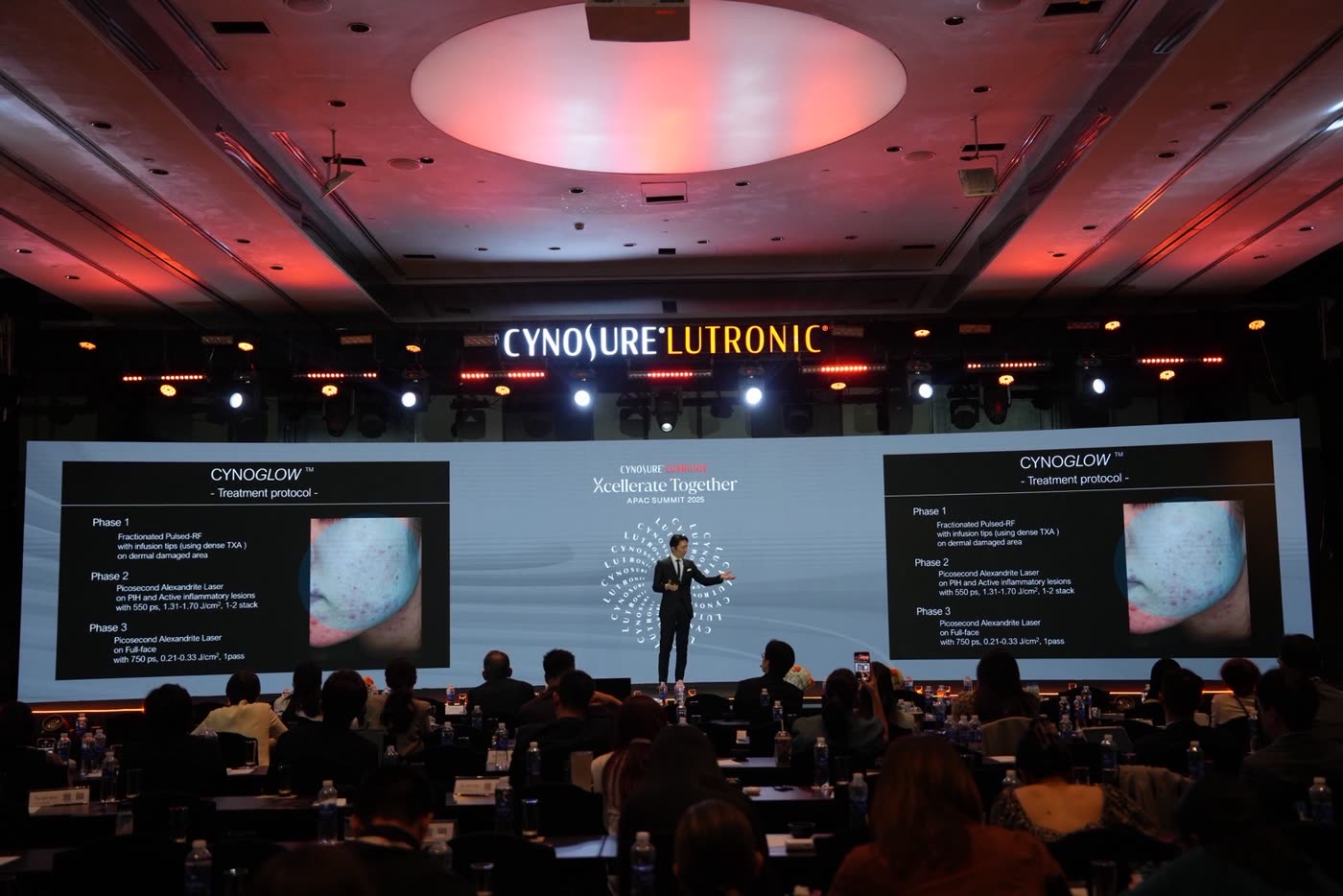Cynosure社のアジア太平洋サミットで治療プロトコールを講演する奥謙太郎医師