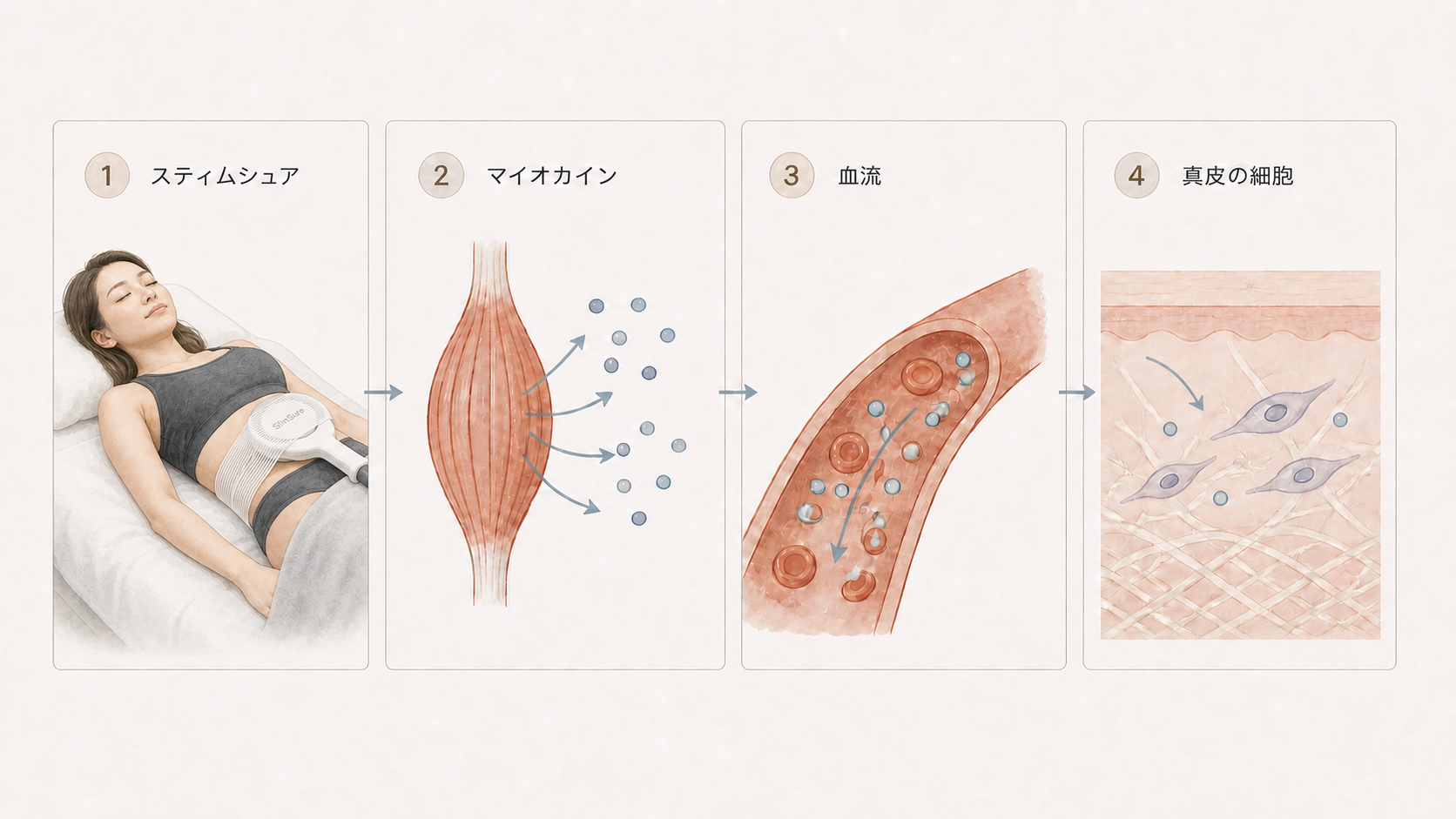 スティムシュアによる筋肉の収縮からマイオカイン、血流を介して真皮の細胞へ届くまでを示す4段階の水彩イラスト